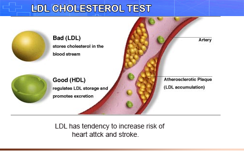 LDL Cholesterol là gì