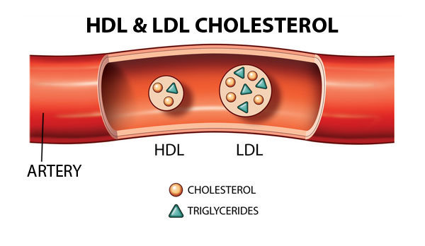 LDL và HDL -C là gì, khác nhau như thế nào