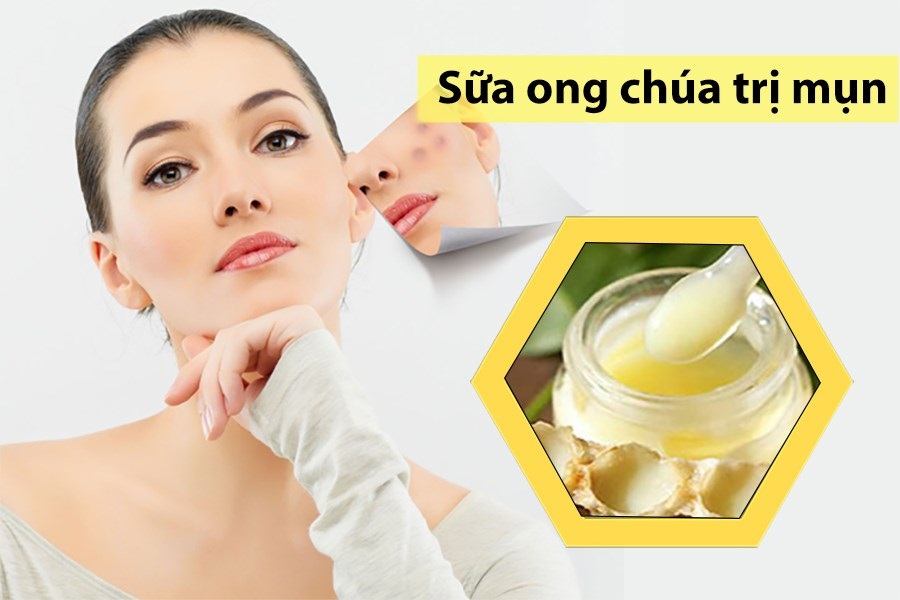 Đắp mặt nạ sữa ong chúa tươi để dưỡng da, trị mụn