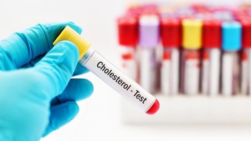 Bệnh cholesterol là gì ?