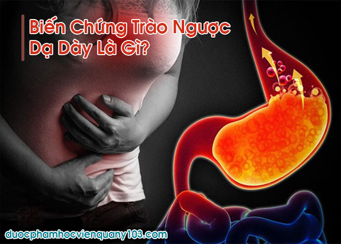 Biến Chứng Trào Ngược Dạ Dày Là Gì?