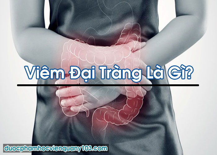 Viêm Đại Tràng